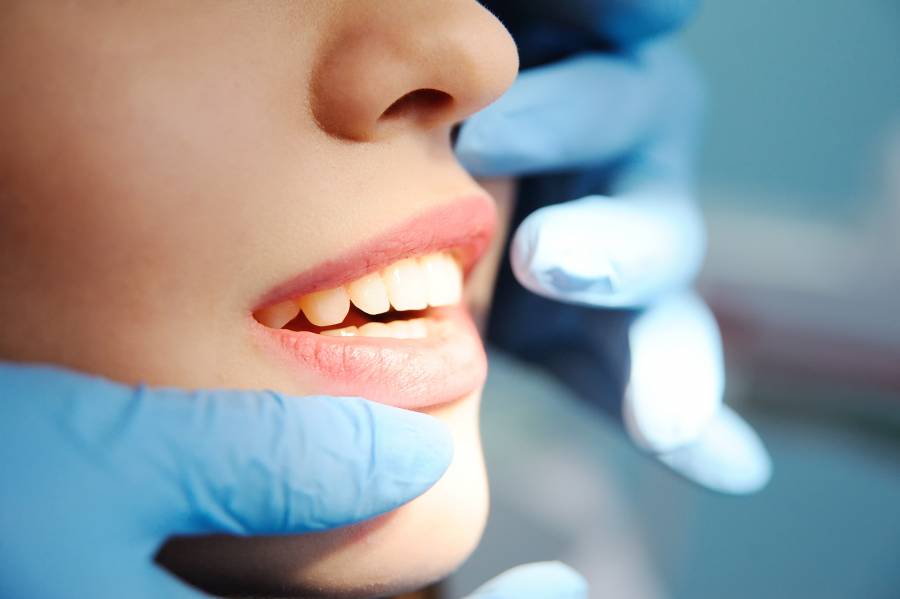 Esthétique dentaire, chirurgie plastique pour un beau sourire avec le Cabinet Maupassant